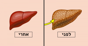 אלומיניום בכבד - כך תנקו אותו, בעזרת 4 מזונות שכולנו מכירים
