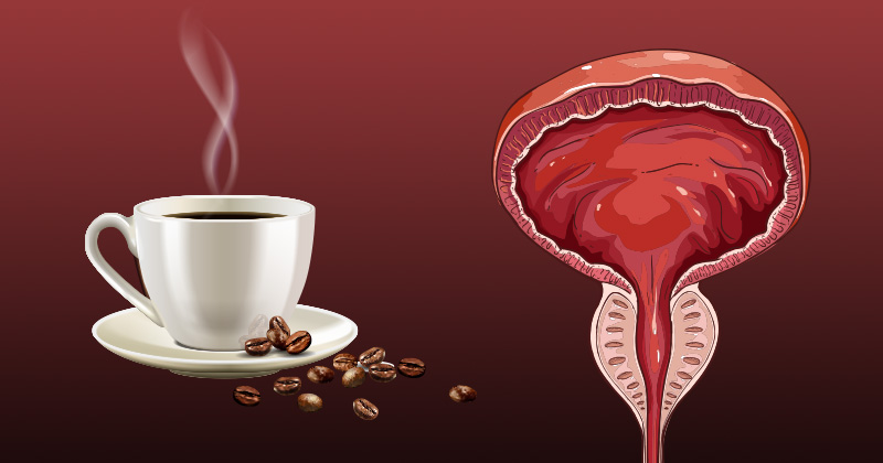 קפה שחור מונע את סרטן הערמונית