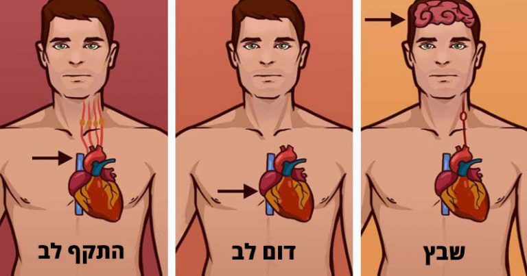 התקף לב דום לב שבץ מוחי