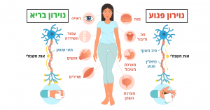 טרשת נפוצה, 5 טיפים שיסייעו לכם להקל על התסמינים