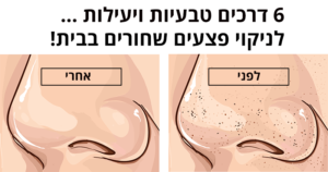 6 דרכים טבעיות ויעילות לניקוי פצעים שחורים בבית