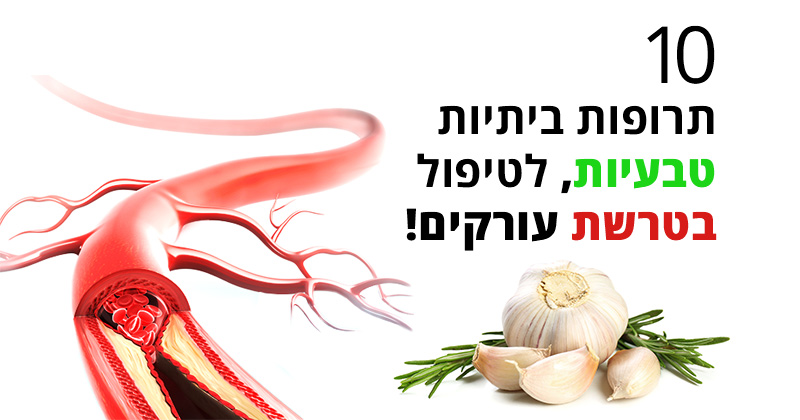 טרשת עורקים - 10 תרופות ביתיות טבעיות ותזונה מומלצת