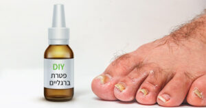 פטרת ברגליים, מתכון לספריי טבעי וקל להכנה
