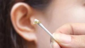 5 תרופות ביתיות לניקוי שעווה מהאוזניים – ומדוע הגוף מייצר אותה