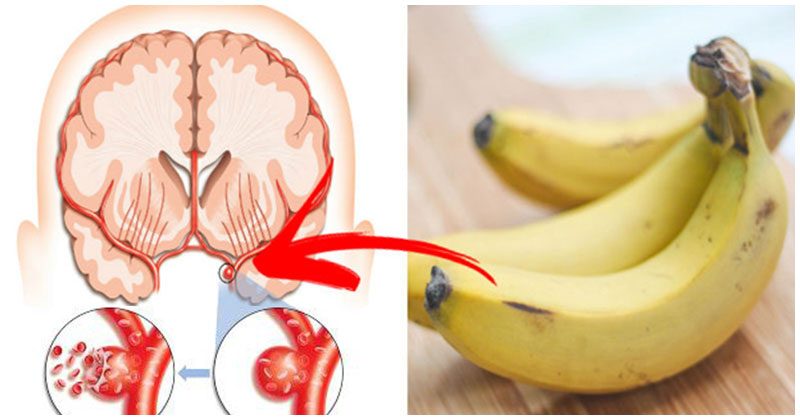 היתרונות הבריאותיים שתקבלו מאכילת 3 בננות ביום