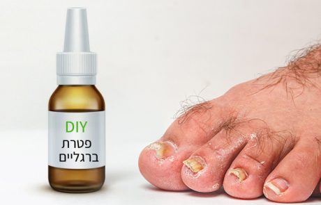 פטרת ברגליים, מתכון לספריי טבעי וקל להכנה