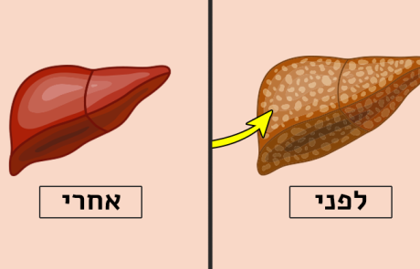 אלומיניום בכבד – כך תנקו אותו, בעזרת 4 מזונות שכולנו מכירים