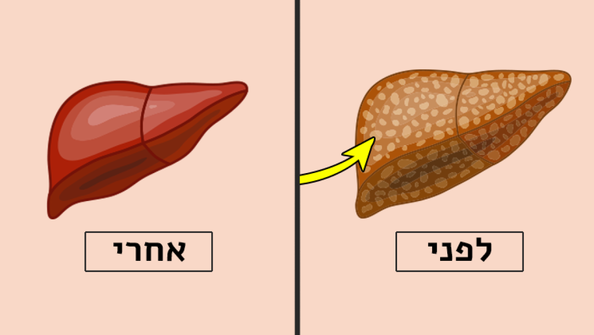 אלומיניום בכבד - כך תנקו אותו, בעזרת 4 מזונות שכולנו מכירים