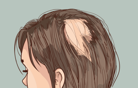 אבץ - 15 יתרונות בריאות שכולם צריכים לדעת