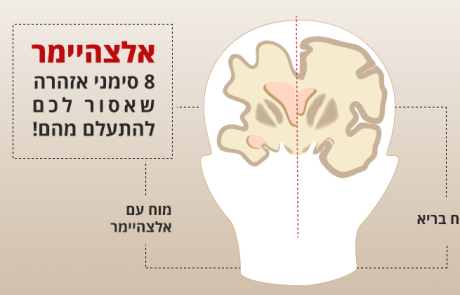 אלצהיימר, 8 סימני אזהרה שאסור לכם להתעלם מהם!