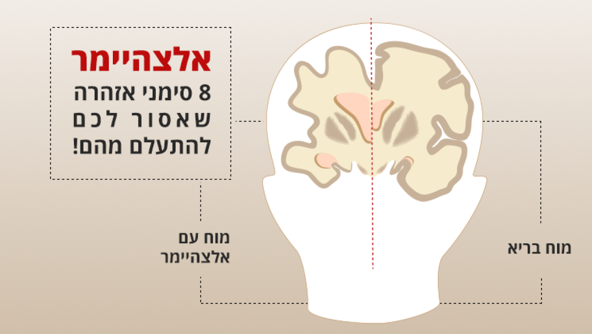 אלצהיימר, 8 סימני אזהרה שאסור לכם להתעלם מהם!