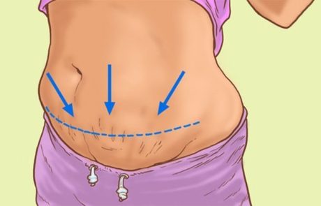 9 הסיבות לכך שיש לנו בטן נפוחה