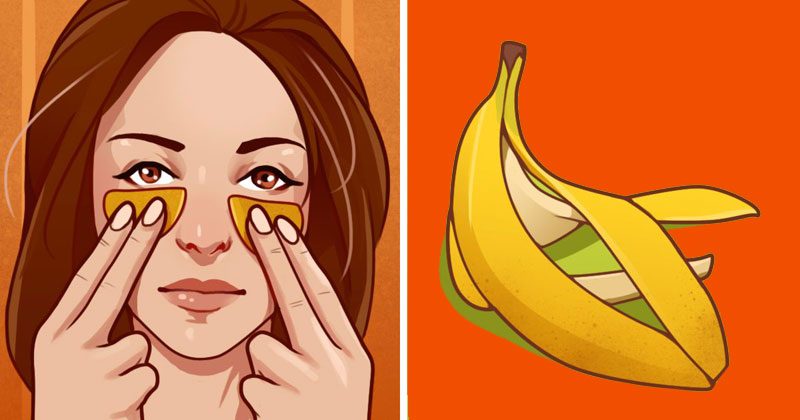 קליפת בננה – 11 שימושים מפתיעים שכדאי לדעת