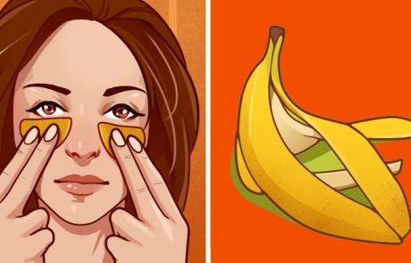 קליפת בננה - 11 שימושים מפתיעים שכדאי לדעת