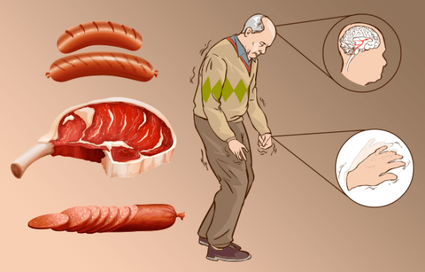 זה מה שקורה לתאי ולמבנה המוח שלכם כשאתם אוכלים בשר במשך 5 שנים