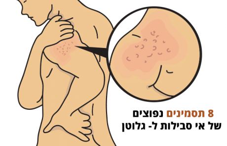 תסמינים של אי סבילות לגלוטן שהם לא בהכרח צליאק