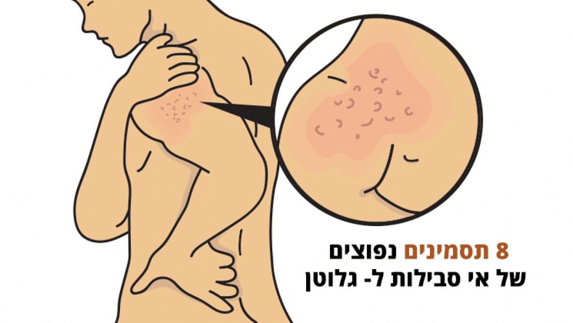 תסמינים של אי סבילות לגלוטן שהם לא בהכרח צליאק