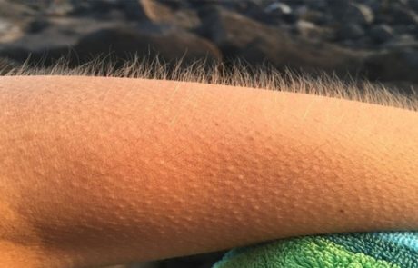 9 דברים משונים שהגוף שלנו עושה ומעולם לא ידענו שהם מנגנוני הגנה