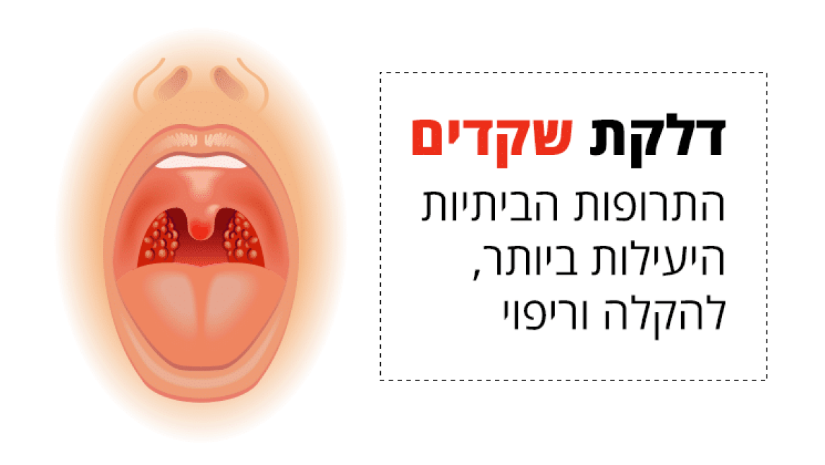 דלקת שקדים, התרופות הביתיות היעילות ביותר להקלה וריפוי