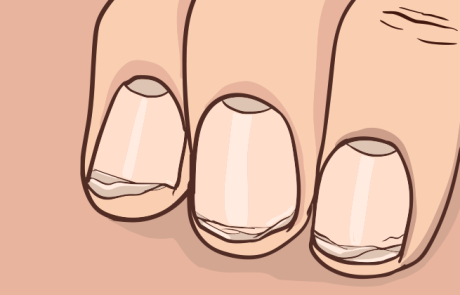 4 המזונות הטובים ביותר לחיזוק הציפורניים