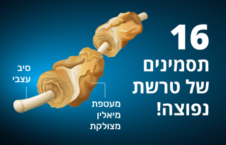 טרשת נפוצה, 16 התסמינים שעליכם לשים לב אליהם