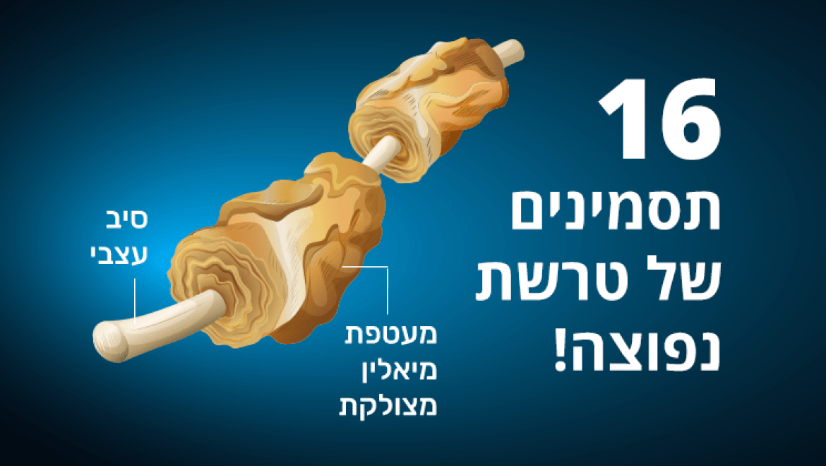 טרשת נפוצה, 16 התסמינים שעליכם לשים לב אליהם