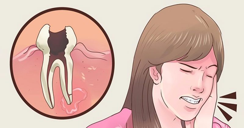 משחה ביתית וטבעית להקלה על כאבי שיניים תוך 2 דקות