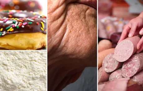 המאכלים שגורמים לעור שלכם להזדקן מהר יותר - וזה לא רק סוכר!