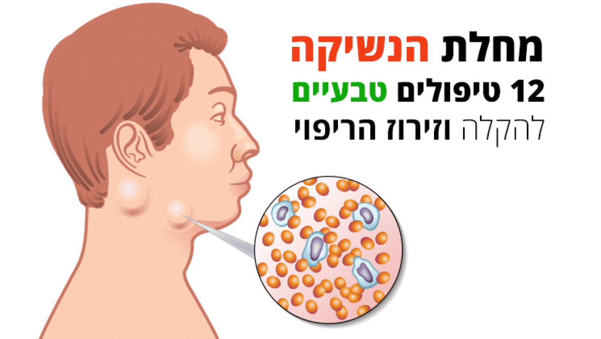 מחלת הנשיקה, 12 טיפולים טבעיים להקלה וזירוז הריפוי