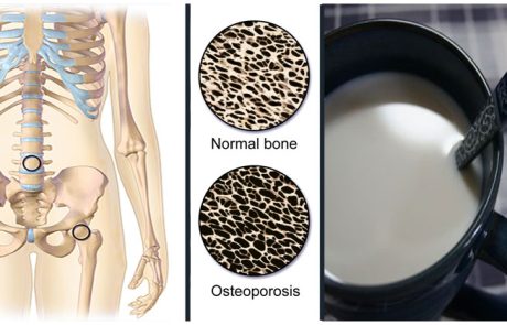 מחקר שוודי חושף – שתיית חלב מקצרת את החיים שלכם