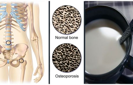 מחקר שוודי חושף - שתיית חלב מקצרת את החיים שלכם