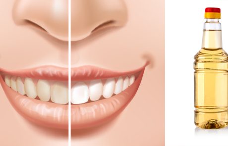 מי פה טבעיים ויעילים להלבנת השיניים וריפוי החניכיים
