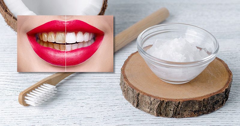 3 סיבות טובות לצחצח שיניים עם שמן קוקוס