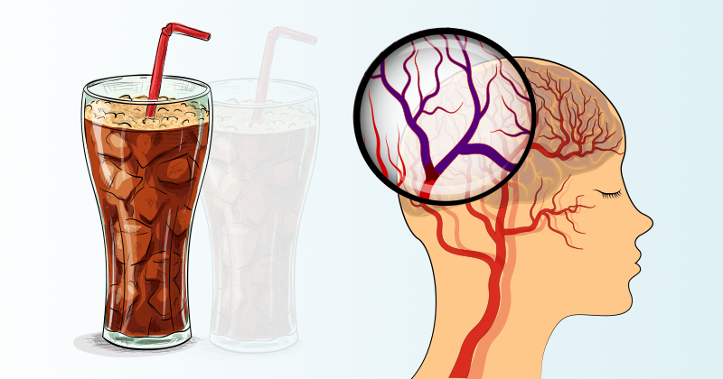 על פי מחקרים – משקאות הדיאט מעלים את הסיכון לשבץ ודמנציה