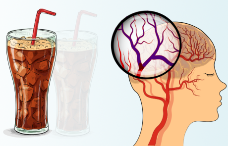 על פי מחקרים - משקאות הדיאט מעלים את הסיכון לשבץ ודמנציה