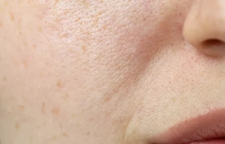 עור יבש, שמן או משולב? כך תגלו בעזרת 4 בדיקות פשוטות!