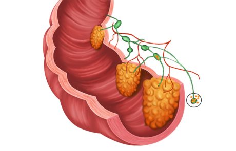 סיבים תזונתיים, כמה צריך לאכול כדי למנוע מחלות
