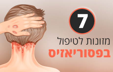 פסוריאזיס, תזונה ומגוון רחב של טיפולים טבעיים