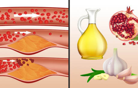 10 מאכלים מפתיעים הפותחים את העורקים, בדרך טבעית לחלוטין