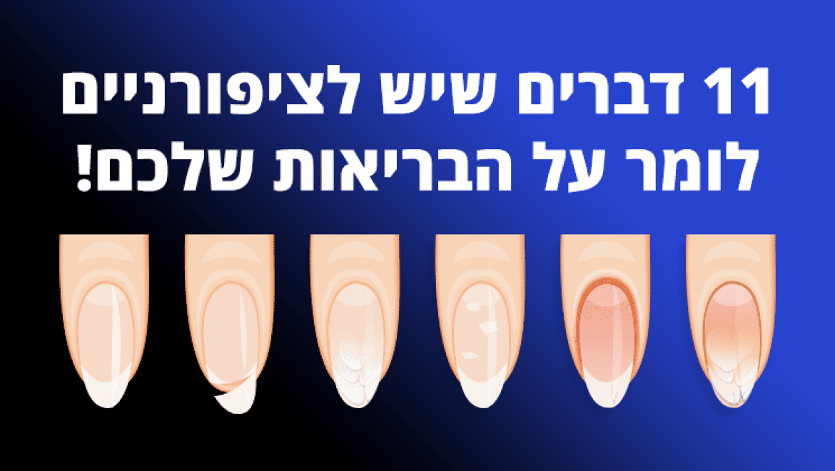 11 דברים שיש לציפורניים לומר על הבריאות שלכם