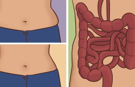 מחלת צליאק - גורמים ותסמינים