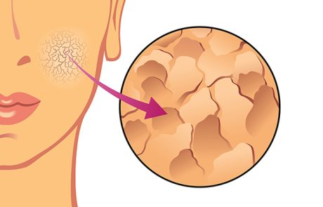 רופאי עור אומרים שאנחנו לא באמת זקוקים לקרם לחות