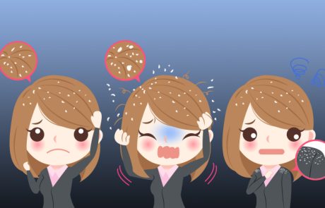 חומץ תפוחים נגד קשקשים, כך עושים את זה!