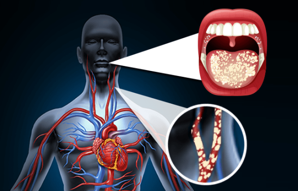שיניים, היגיינה, מחלות לב ומחקר חדש שחשף את הקשר ביניהן