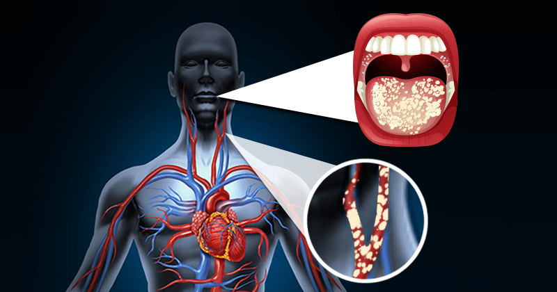 שיניים, היגיינה, מחלות לב ומחקר חדש שחשף את הקשר ביניהן